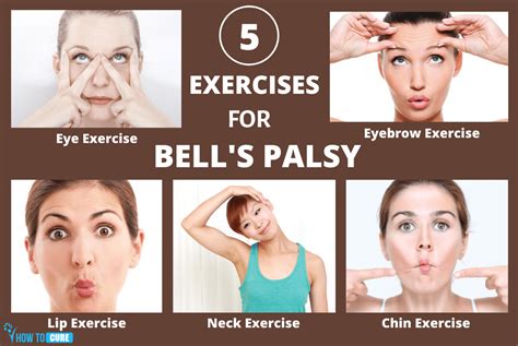 bell's palsy treatment at home